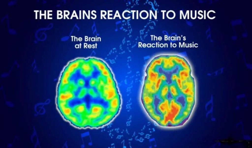 musicbrain 1600px 22 Ways To Give Off Positive Vibes | The Science
